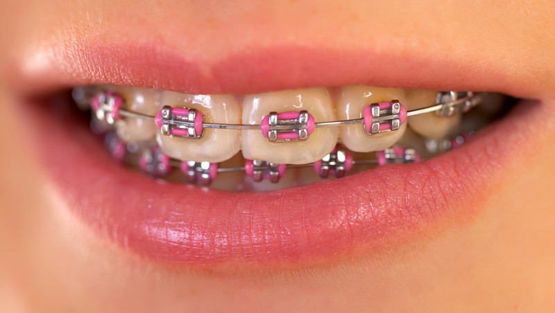 emergency orthodontic treatment