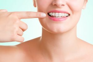 orthodontic myths