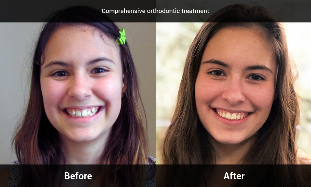 comprehensive orthodontic treatment