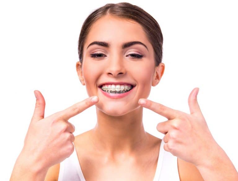 Braces For Adults Orthodontic Treatment For Ageless Beautiful Smile