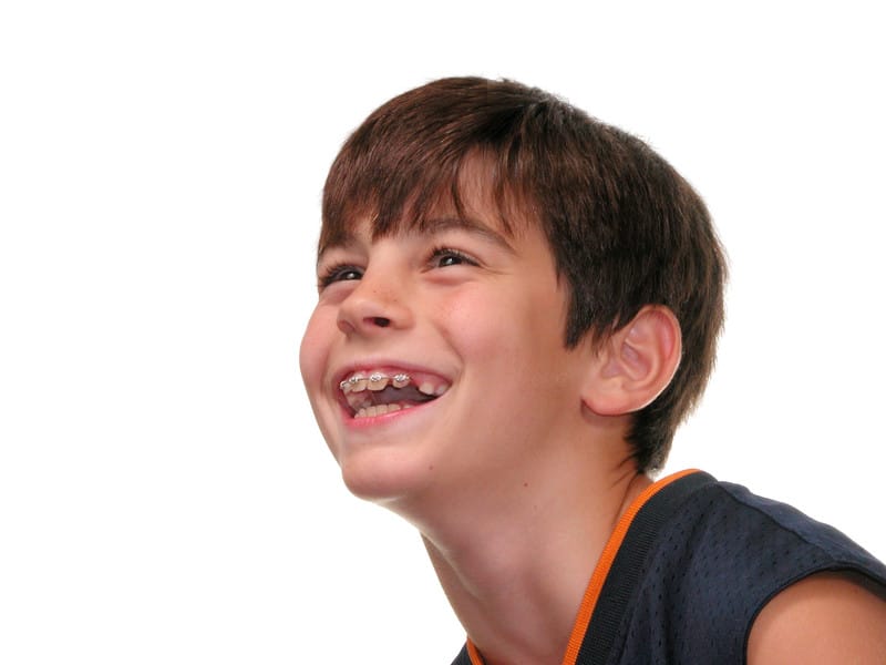 Orthodontics for Children How To Make Wearing Braces Fun for Kids
