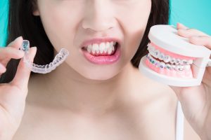 At-home Teeth Straightening Kits
