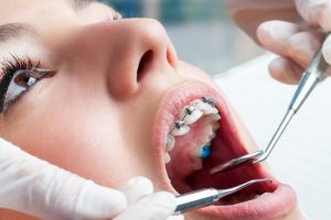 dental emergencies