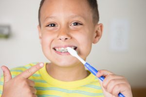 how to stay cavity-free during braces