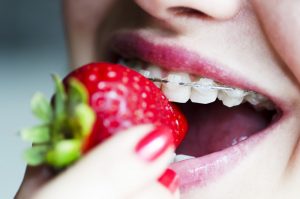 orthodontic treatment and healthy diet