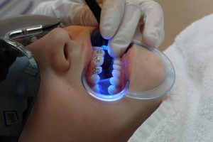 orthodontist care