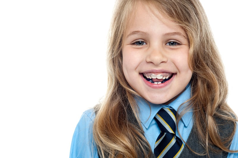 Child Braces Orthodontic Treatment & Dental Care For Children